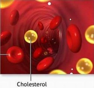 Cholesterol