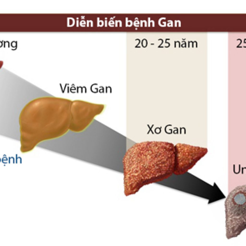 nguyen-nhan-hang-dau-gay-benh-gan-va-phuong-phap-bao-ve