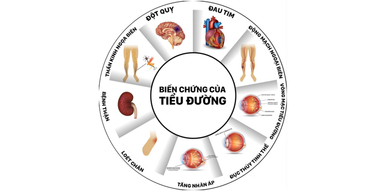 biến chứng bệnh tiểu đường