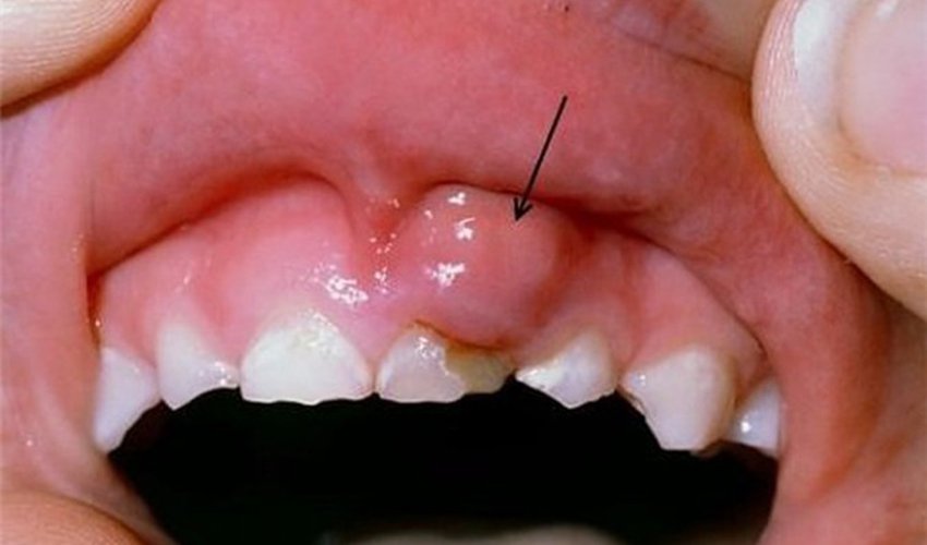 Những vấn đề răng miệng là dấu hiệu của bệnh nghiêm trọng