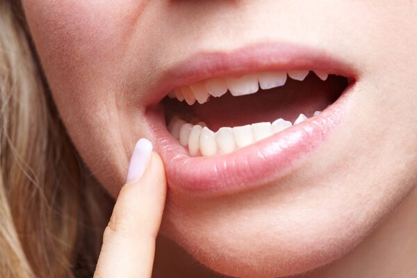 Những vấn đề răng miệng là dấu hiệu của bệnh nghiêm trọng