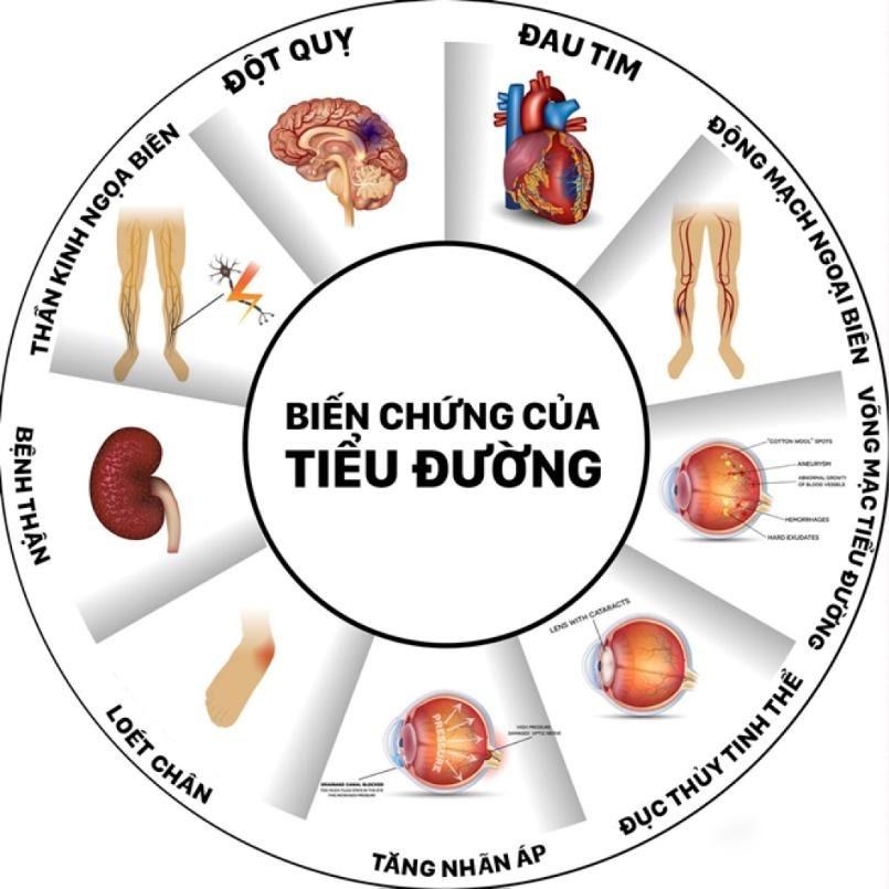 Biến chứng tiểu đường gây mù mắt 